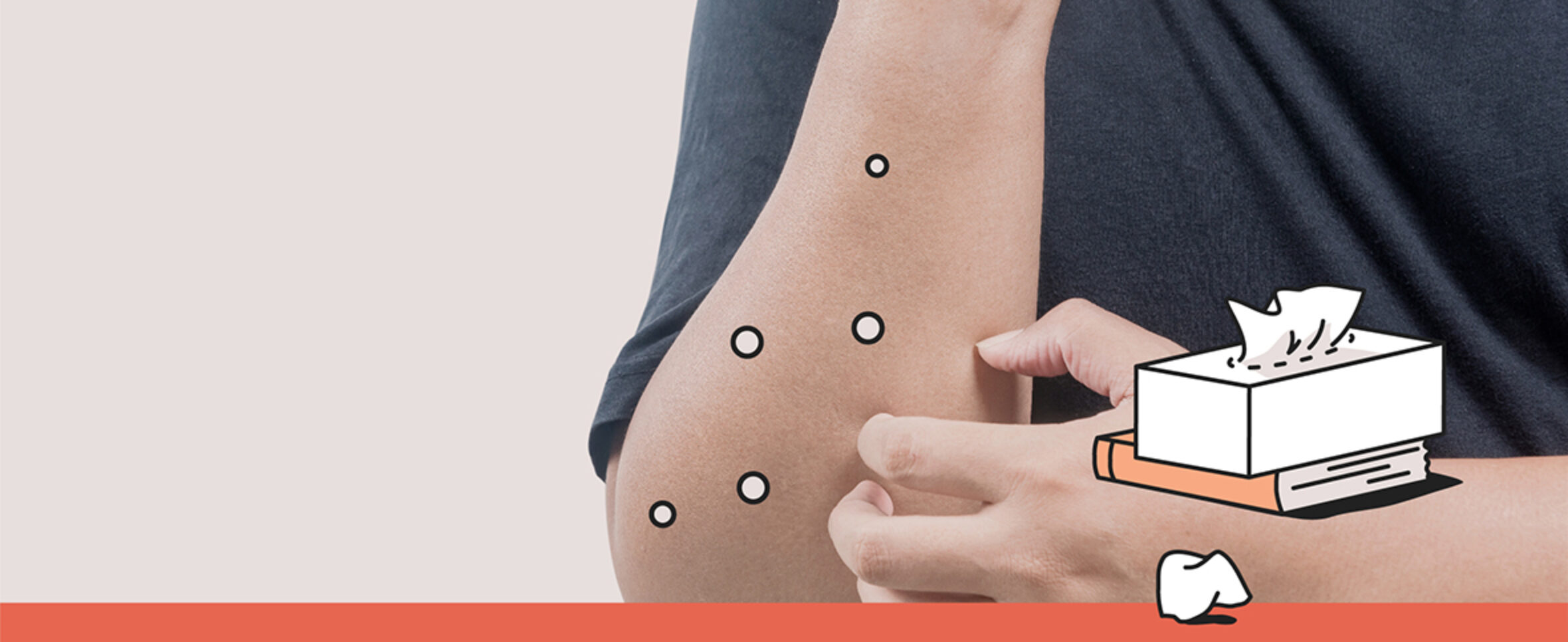 Monkeypox symptoms, causes, and treatment Maple