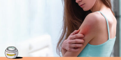 Prickly heat (heat rash): symptoms, treatment, and prevention