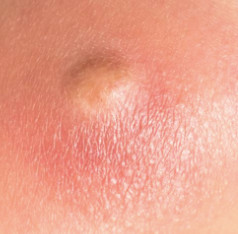 Closeup shot of a node.