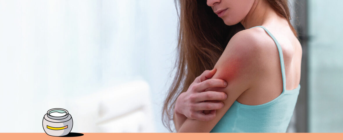 Young Canadian woman looking at eczema on her arm.