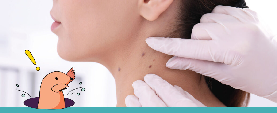 Dermatologist examining a small mole on a woman's neck.